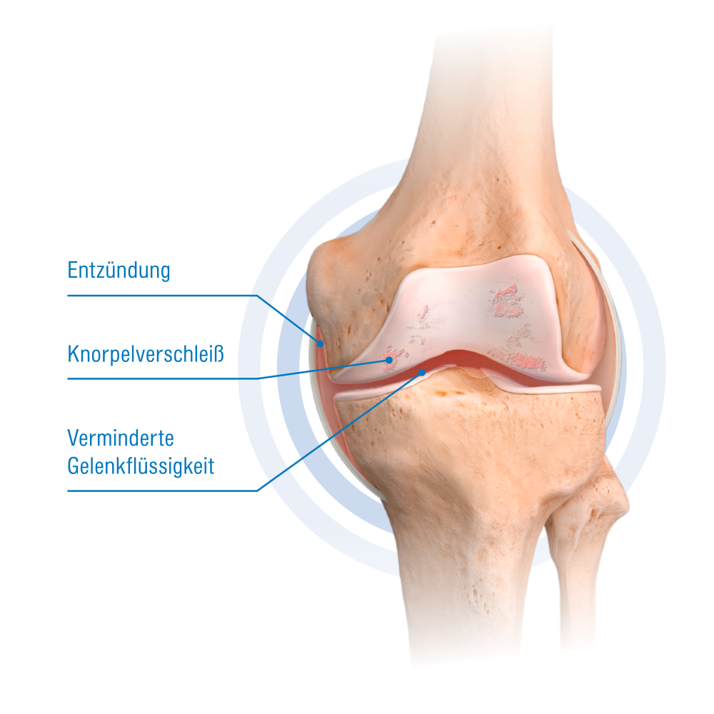 Knie mit Beschriftungen